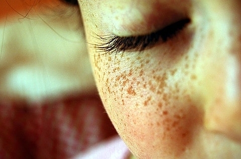 dream,  eye and  freckles