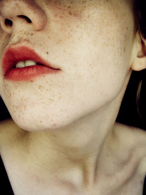 closeup, face and freckles