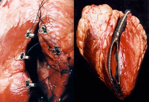 anatomy, blood and clasps