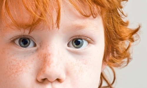 beautiful child,  boy and  freckle