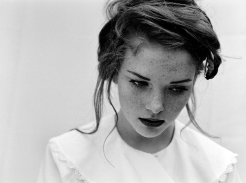 black and white, freckles and girl