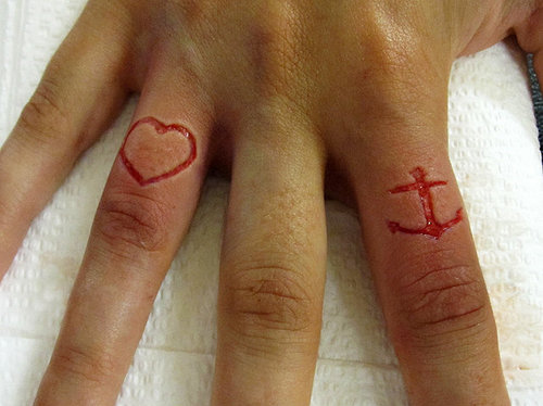 Gross Heart