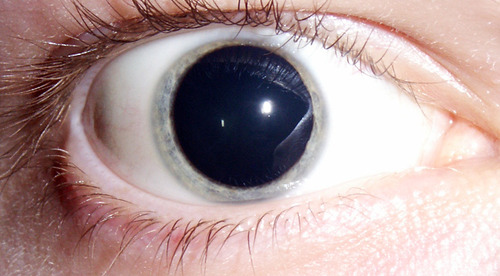 dilated-dorgas-fish-eyes-lsd-pupils-Favim.com-104670.jpg
