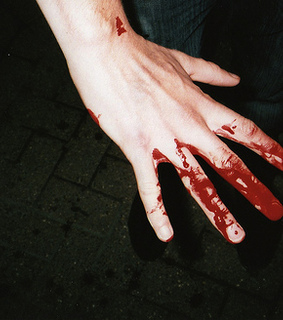 blood, boy and bruise
