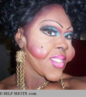 fail, plastic surgery and self shot