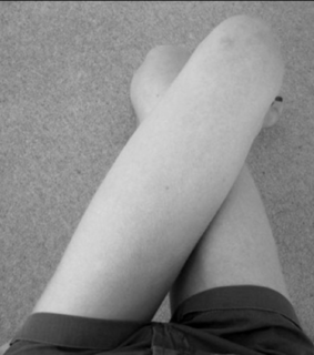 anorexia, bulimia and gap
